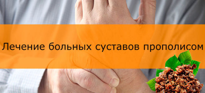 Лечение прополисом суставов — лучшие рецепты и рекомендации