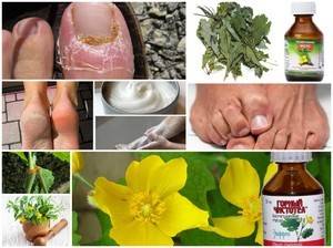 Чистотел: от грибка ногтей на ногах, рецепты и создание масла на основе растения