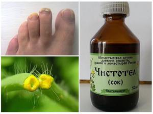 Чистотел: от грибка ногтей на ногах, рецепты и создание масла на основе растения