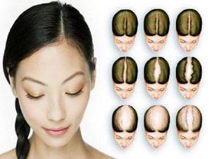 Удаление волос с помощью куркумы: как использовать для депиляции, рецепты эффективных масок
