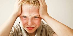 Внутричерепное давление: симптомы у взрослых и детей