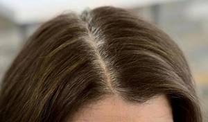 Седые волосы: механизм появления и причины ранней седины