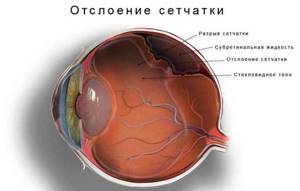 Упражнения для глаз для улучшения зрения: методика