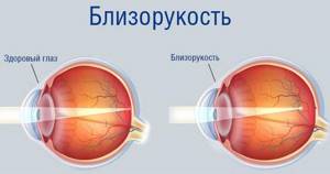 Упражнения для глаз для улучшения зрения: методика