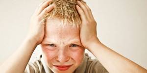 Ветряная оспа - симптомы и особенности у детей и взрослых