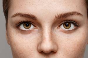 Пигментные пятна на лице: основные типы и причины появления