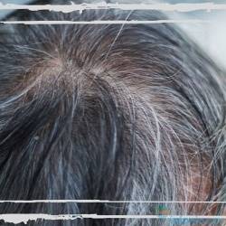 Седые волосы: механизм появления и причины ранней седины
